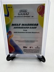 2025 Bowman Chrome Zyhir Hope Melt Mashers Auto Autograph #/99 Dodgers Tigers