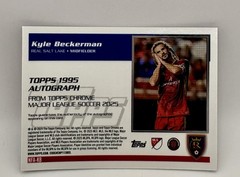 2025 Topps Chrome MLS Kyle Beckerman Purple Donut Holes Auto# 31/75 NFA-KB RSL